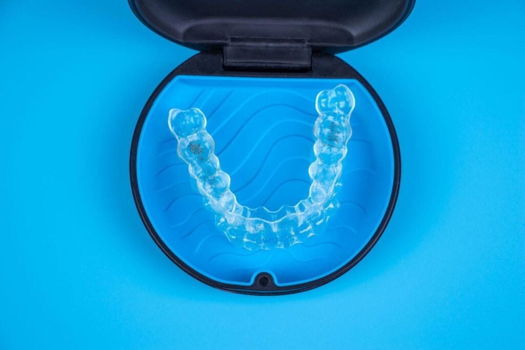 Retainer after braces. After-care for orthodontic treatments in Tirana.