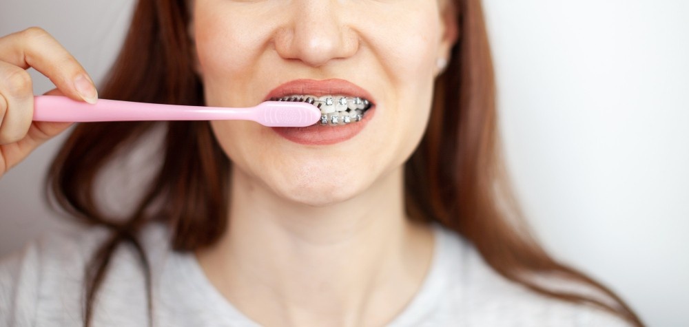 Proper brushing technique for braces
