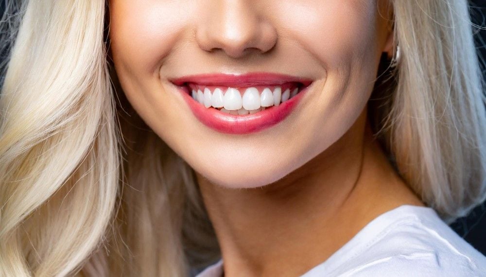 teeth whitening treatment in Albania, affordable teeth whitening, professional teeth whitening for sensitive teeth