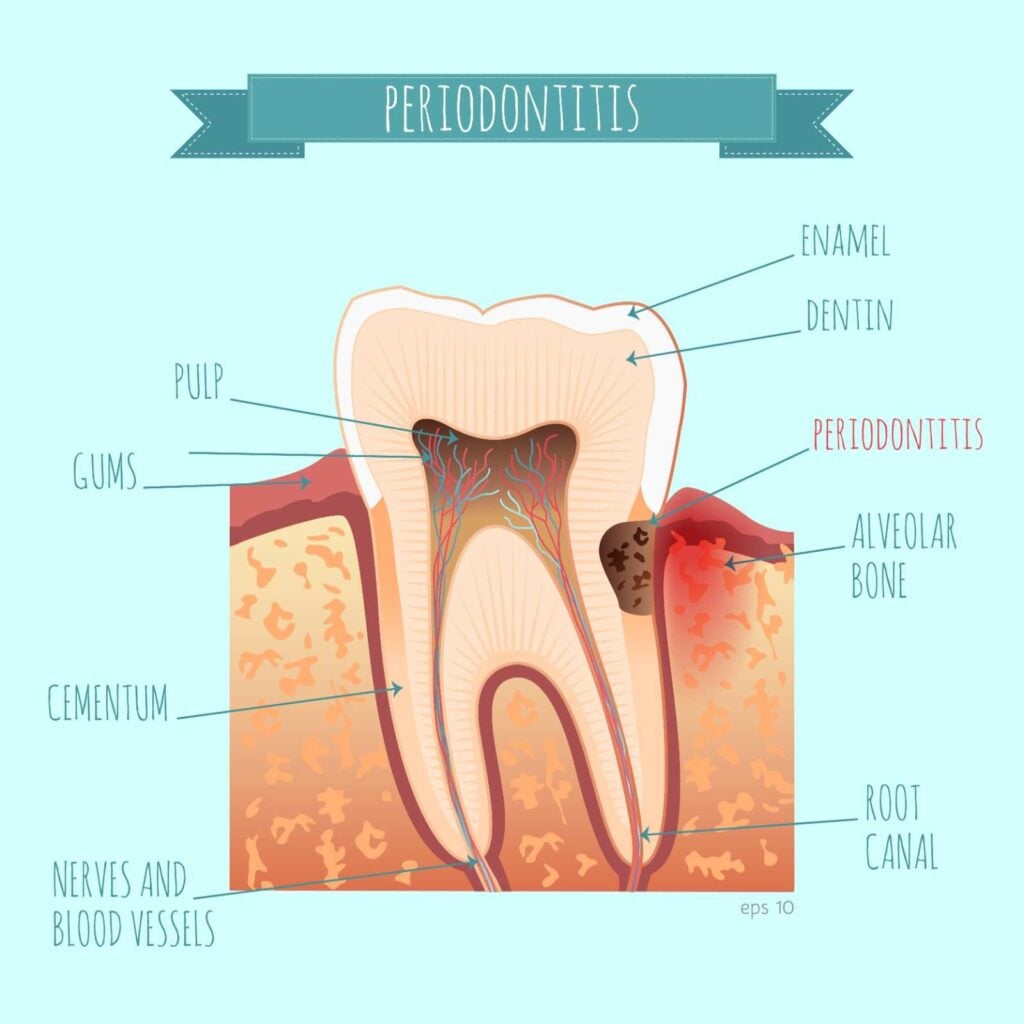 root canal structure