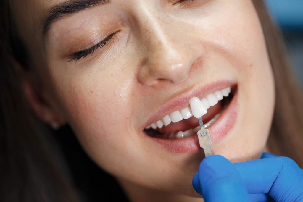 affordable emax veneers in Albania