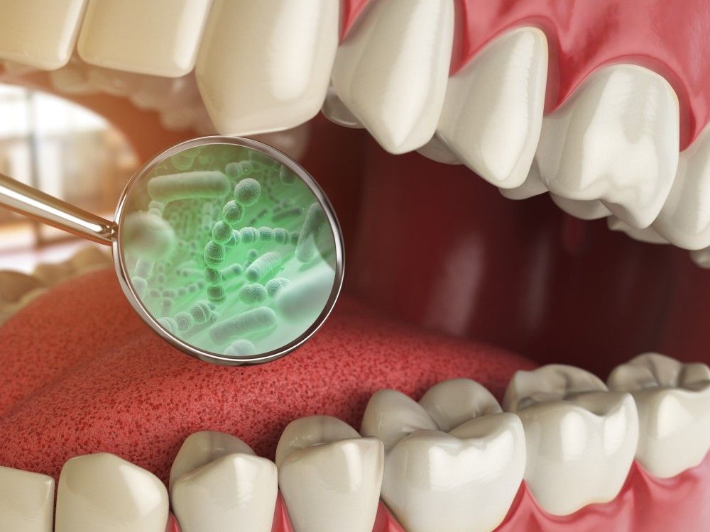 root tooth infection