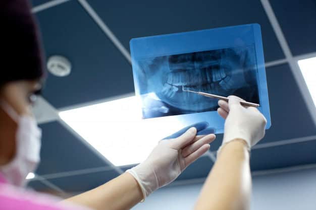 radiografia panoramica