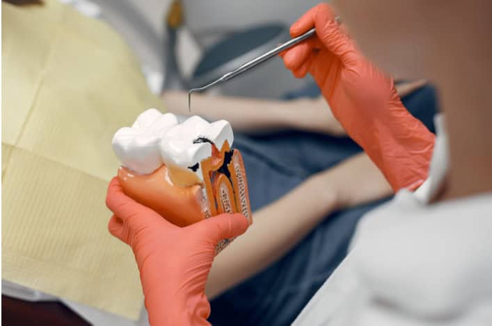 Immagine che illustra gli impianti dentali con per pazienti con poco osso.