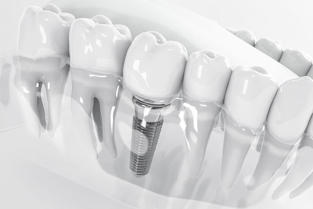 la migliore clinica per trattamenti dentistici in Albania