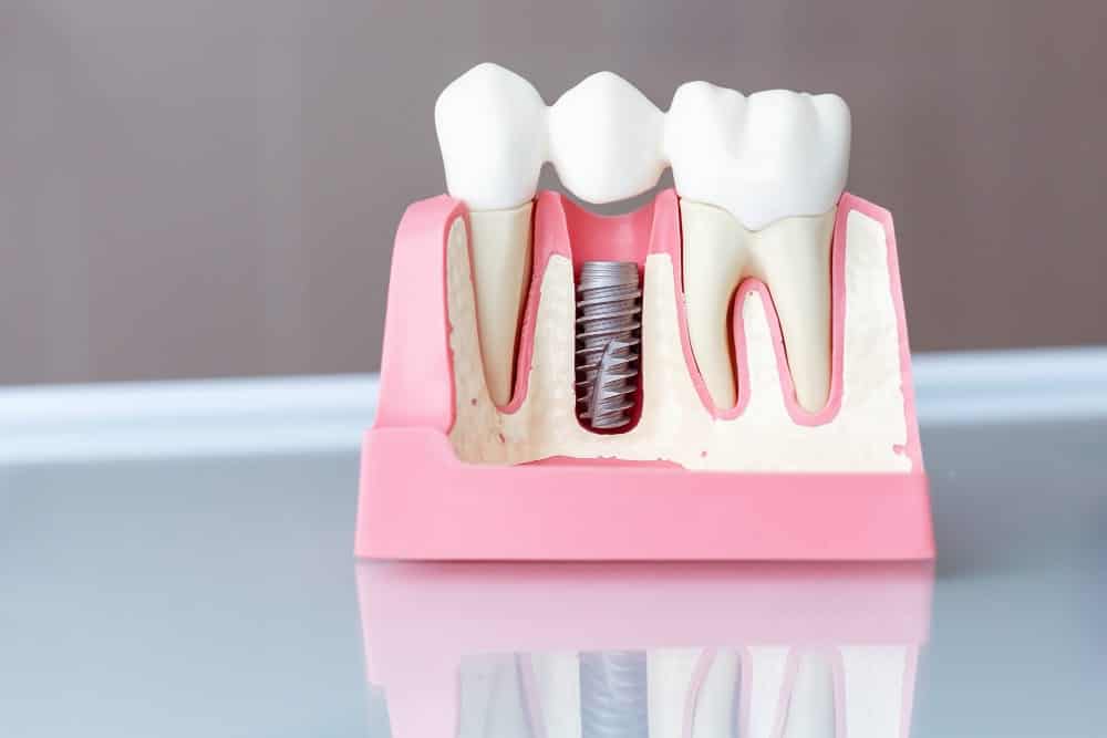 la migliore clinica dentale in Albania