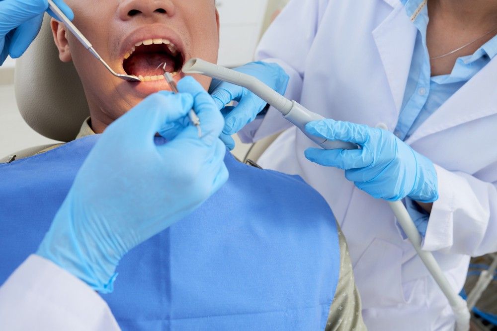 Mbushje dentare ne Tirane