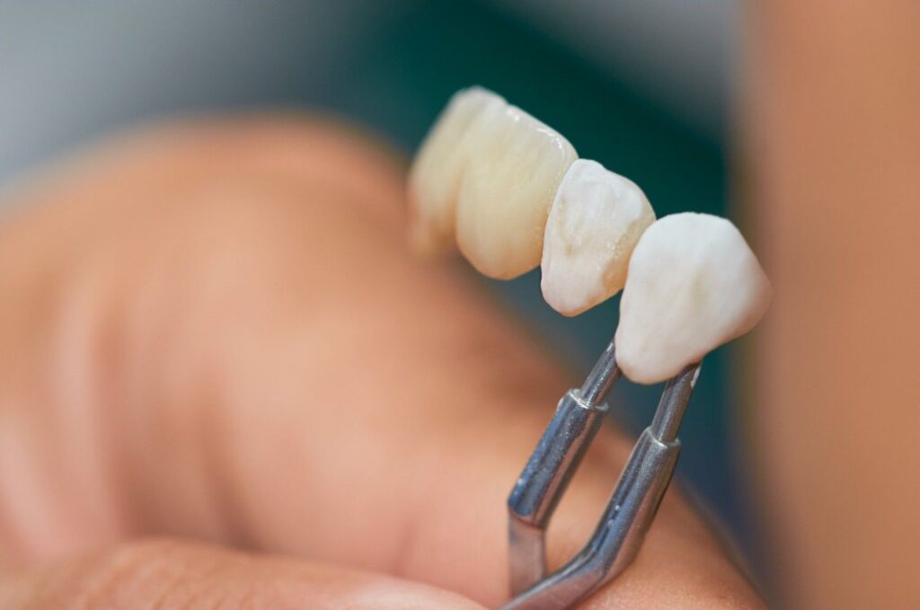 close up hand holding artificial teeth 1