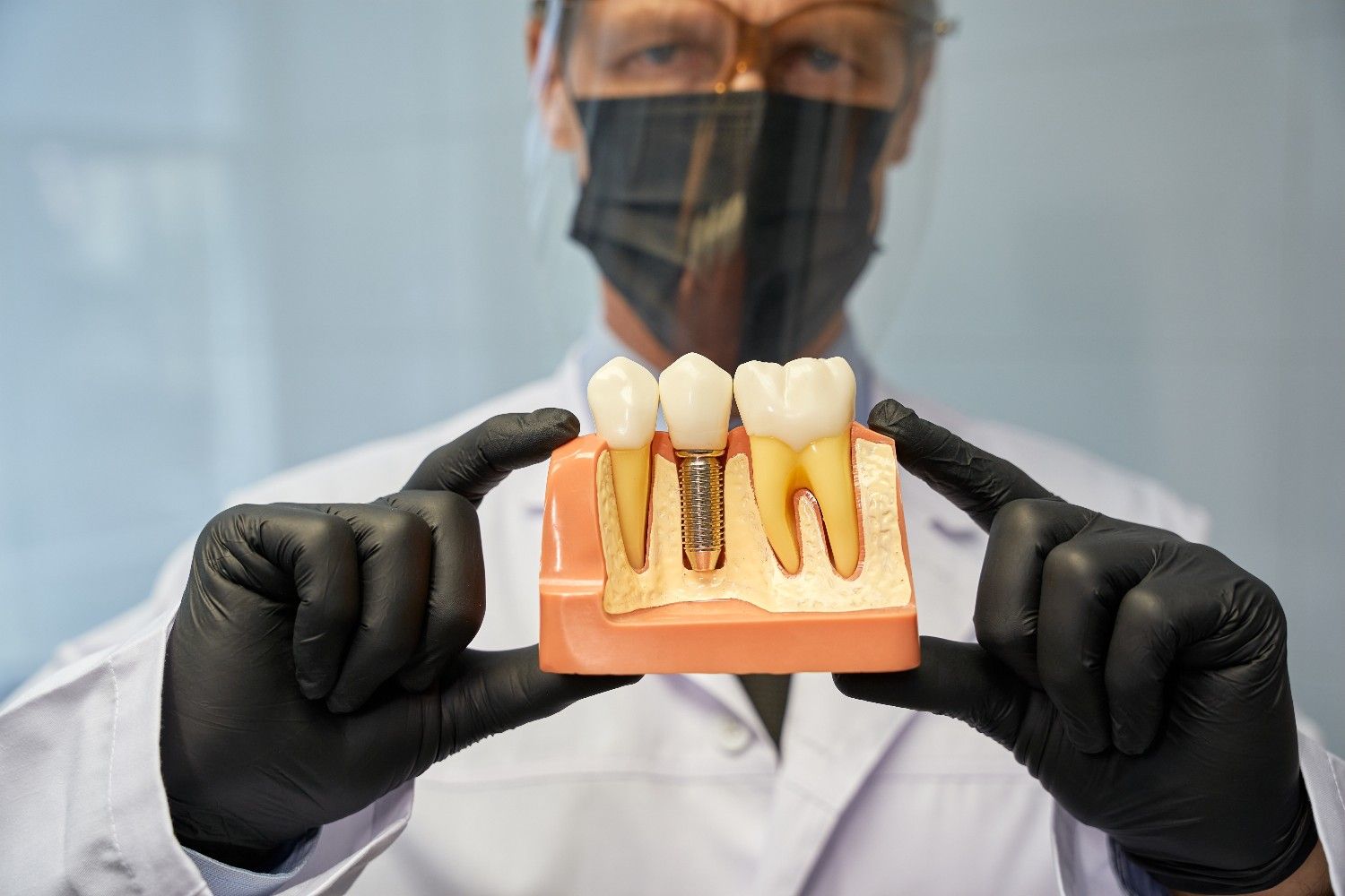 implante dentare ne Shqiperi