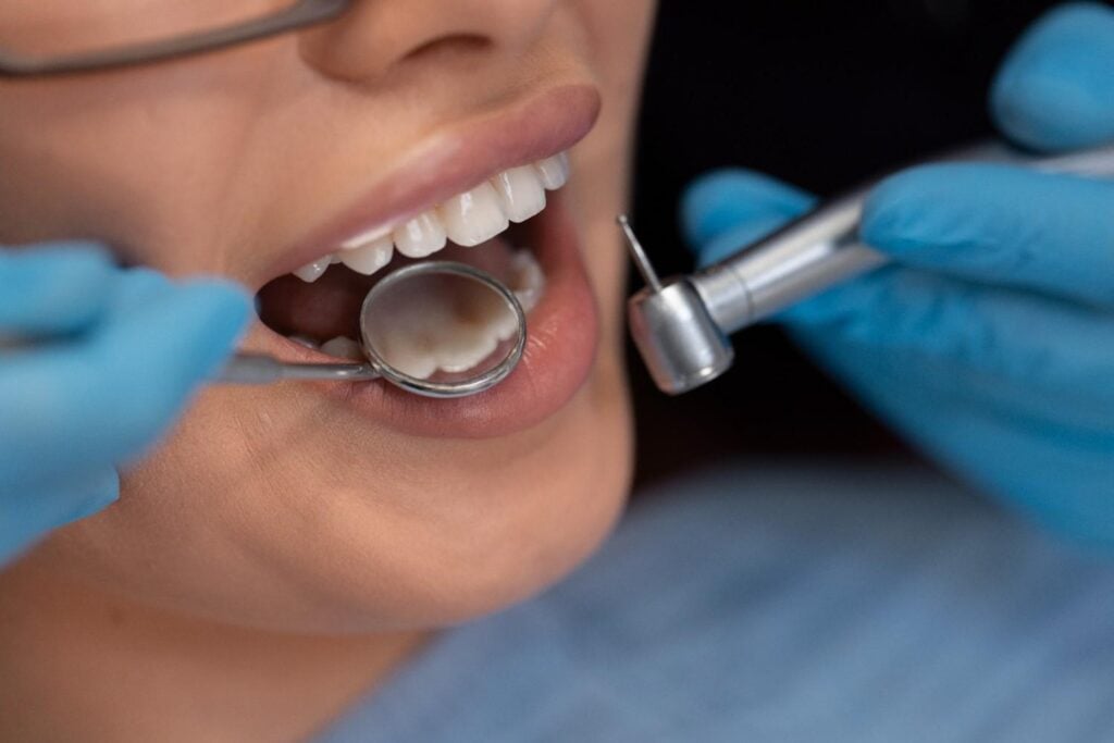 trajtime dentare me cmime ekonomike ne Shqiperi