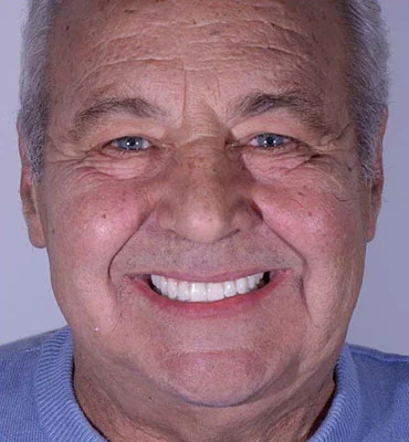 dopo uomo