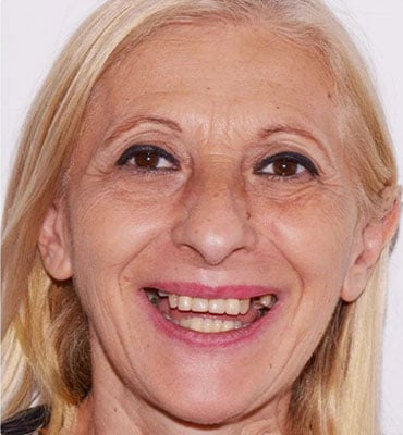primaa