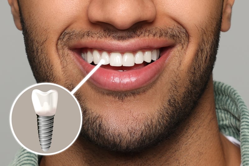 12 24 IMP4 smiling man with perfect teeth