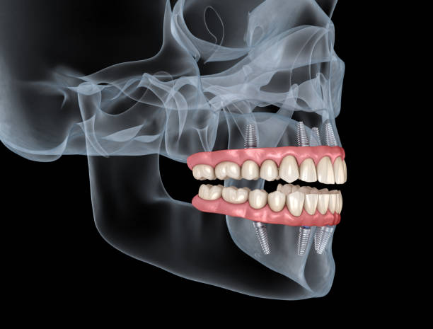istockphoto 1469958440 612x612 1