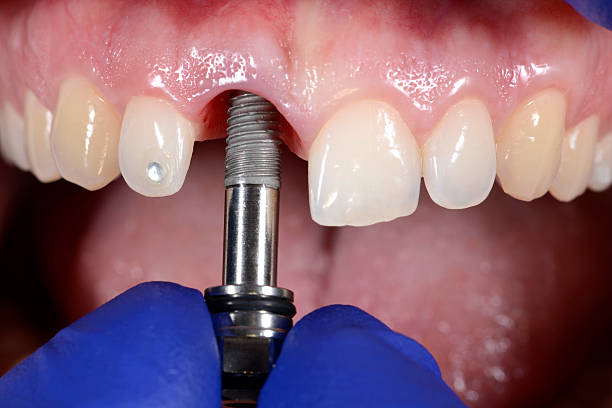 istockphoto 601918330 612x612 1