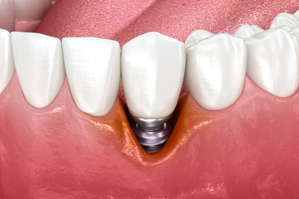 istockphoto 1446865180 612x612 1