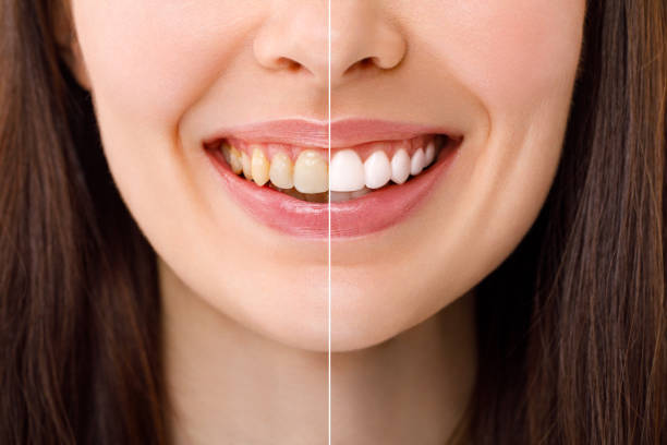 istockphoto 1492174304 612x612 1