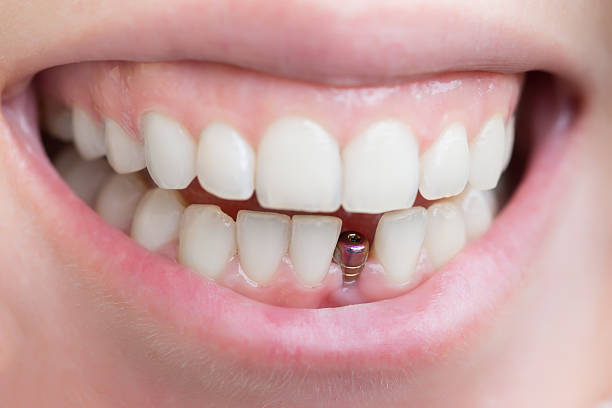 istockphoto 499844042 612x612 1
